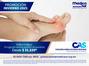 Hallux Valgus (Ciruga de mnima invasin de juanetes) CAS Invierno 2021